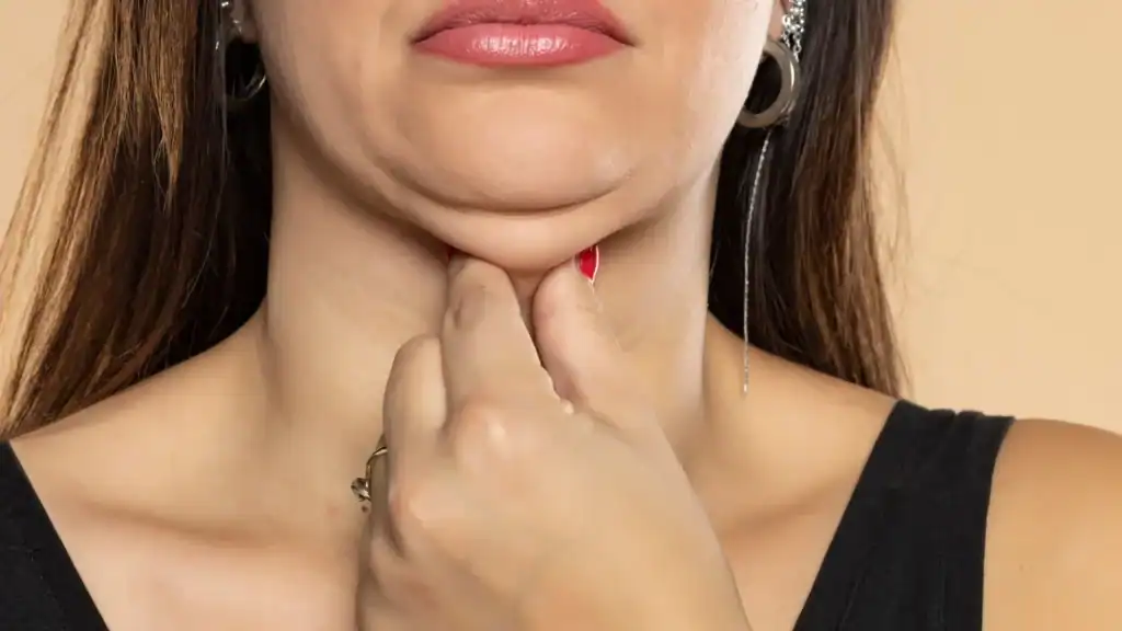 An image of a woman with double chin, sad, worried : Non Surgical Double Chin Removal Treatment in Northfield, UK
