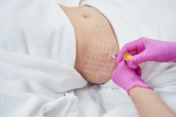 image of fat dissolving injections on love handles to help combat weight gain Northfield