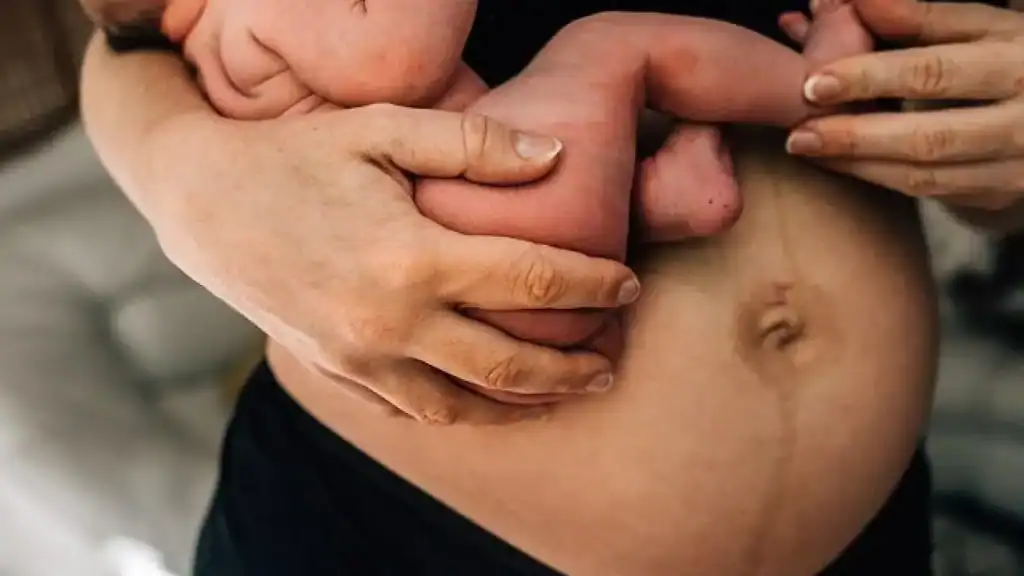 Why Is My Stomach Still Big After Pregnancy Northfield?